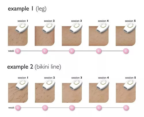 Depilador Láser Ipl Permanente